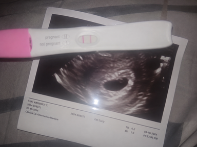 PCOS & Fertility Support